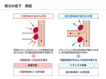 アイケアラボ 熊本辛島町店(アイケアLaBo)/眼の不調【２大要因】
