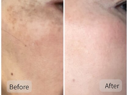 ポレポレ 八尾(polepole.)の写真