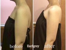 エステティックサロン アールグレー 名古屋駅店/大人気★ブライダル痩身エステ