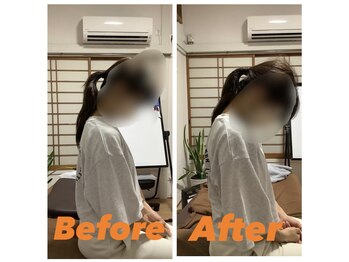 マコア 入谷店(Macore)/首痛肩痛　初回施術