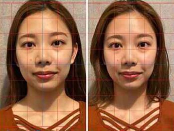 ルディア 堂島店(ledia)/大阪・美容鍼ledia(ルディア)