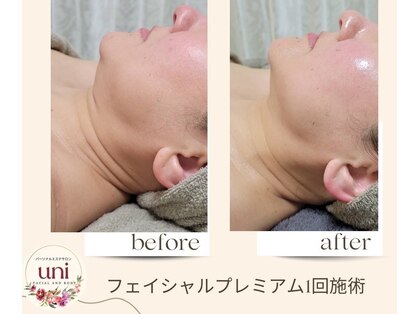 パーソナル ユニ(uni)の写真