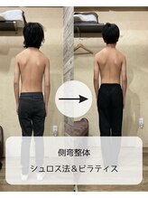 伊集院鍼灸整骨院 千葉中央院/側弯整体＆シュロス＆ピラティス