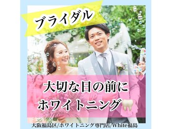 ホワイトニングサロン ホワイト(WHITE)/セルフホワイトニング/大阪/福島
