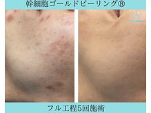 リメイククリニカルビューティー(Remake clinical beauty)/