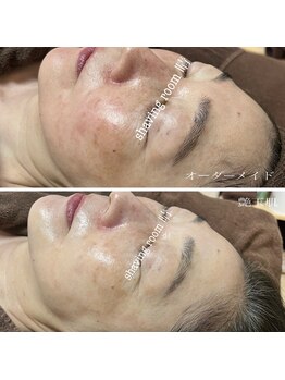 晴(haru)/赤くすみすっきり