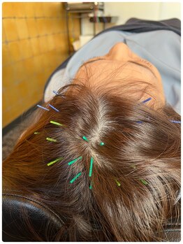 メディカルジャパン 吉祥寺/頭痛や自律神経症状にも有効です