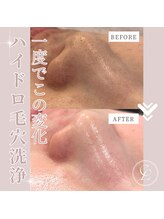 エンルーチェ(en;Luce)/