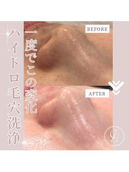 エンルーチェ(en;Luce)/