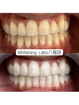 ホワイトニングラボ 八尾店(Whitening Labo)/ホワイトニング専門店/八尾