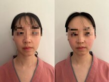 整体 王院長/顔だけじゃない小顔矯正
