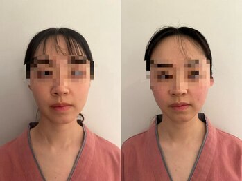 整体 王院長/顔だけじゃない小顔矯正