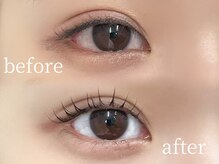 プラチナ 表参道(PLATINA)/Before＆After