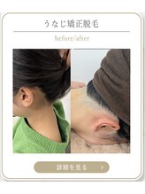 ミース 上野店/リピーター続出の施術