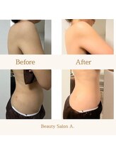 エードット 銀座(A.)/before　→　after