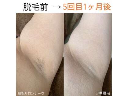レーヴの写真