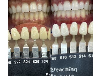 トウキョウスワーズ 池袋店(TOKYO SWRS)/#ホワイトニング #池袋 #渋谷
