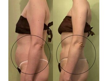 サロンハート(Salon Heart)/あなたに合ったメニューをご提案