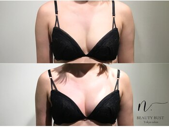 エヌドット 日本橋(N.)/ハリ・弾力アップ☆