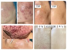 シャルム(charme)