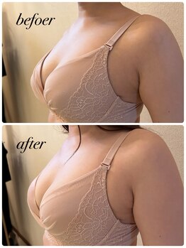 シャルマン(Charmant)/befoer、after