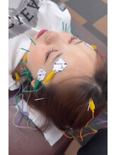 いまはやし鍼灸整体院 香椎和白店/美容鍼