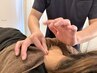 【人気No3/鍼灸を堪能したい方★】鍼灸コース 50分6000円