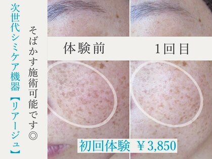 ブランシェ 金沢店 × 椿の写真