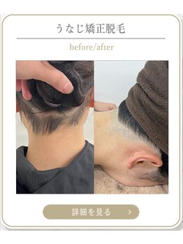 ミース 上野店/首元に自信が持てる♪