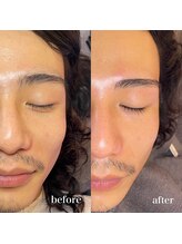 セレーノ(seReno)/アイブロウ×肌質改善セット