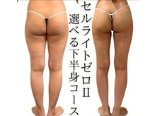 キレイ(KIREI)/衝撃のbefore/after　40代