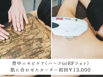 ニキビケア研究所 横浜店/背中ニキビケア・背中エステ