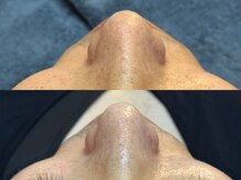 リアン 本町(Lien.)/肌のハリつやを上げるなら！！