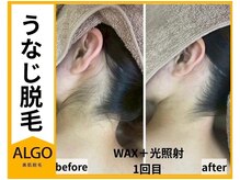 アルゴ 高槻店(ALGO)の雰囲気（【実力派サロン☆】口コミで分かる！効果が早い！のお声多数◎）