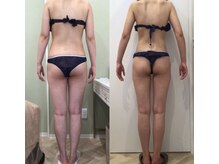 リラパドマ 千葉店(Rela Padma)/激痩せ短期集中ダイエットコース