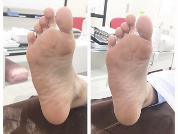 ウノプリール 梅田HARBIS PLAZA(uno pulir)/【フットケア】