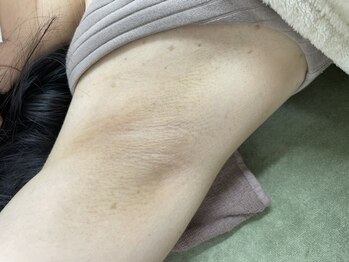 ナノハナ/鹿沼市全身脱毛美容室ナノハナ