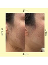 スタイルドアー(style door)/ExoLift 