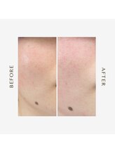 オーシャン(OCEAN)/ムートンホイップスパ