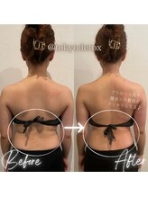 東京デトックス/ブライダルエステ～背中二の腕～