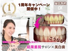 ホワイトニングショップ 多摩店