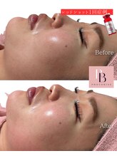 フォトビズ/小顔×エイジングの最強セット