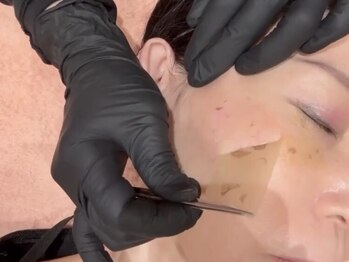 エルフ(elf)の写真/速効実感！話題の”ペリッ”とシミ改善【最新シミケア♪ホワイトラボ★無料相談￥0】驚きの結果に感動♪