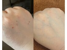 ル シーニュ/お顔と一緒にケア