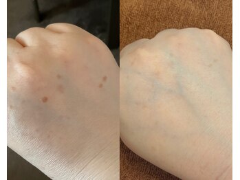 ル シーニュ/お顔と一緒にケア