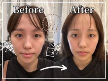 R-1ビューティーサロン 銀座/BEFORE＆AFTER