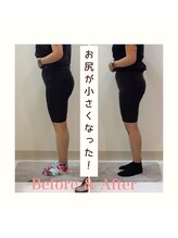 スタイルラボ高松/産後の骨盤矯正の効果♪