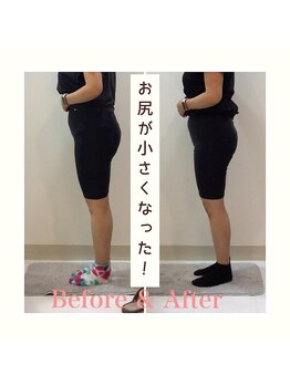 スタイルラボ高松/産後の骨盤矯正の効果♪