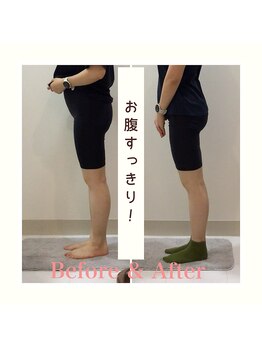 スタイルラボ高松/産後の骨盤矯正の効果♪