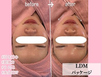 エン クリニカルラボ 心斎橋店(E&N CLINICAL LABO)/LDMパッケージ
